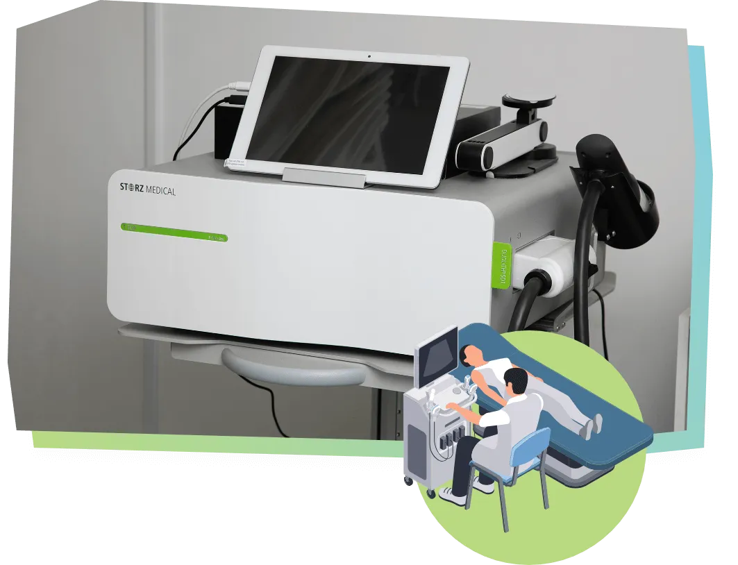 体外衝撃波治療について