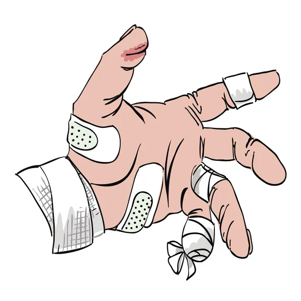 突き指の症状イラスト